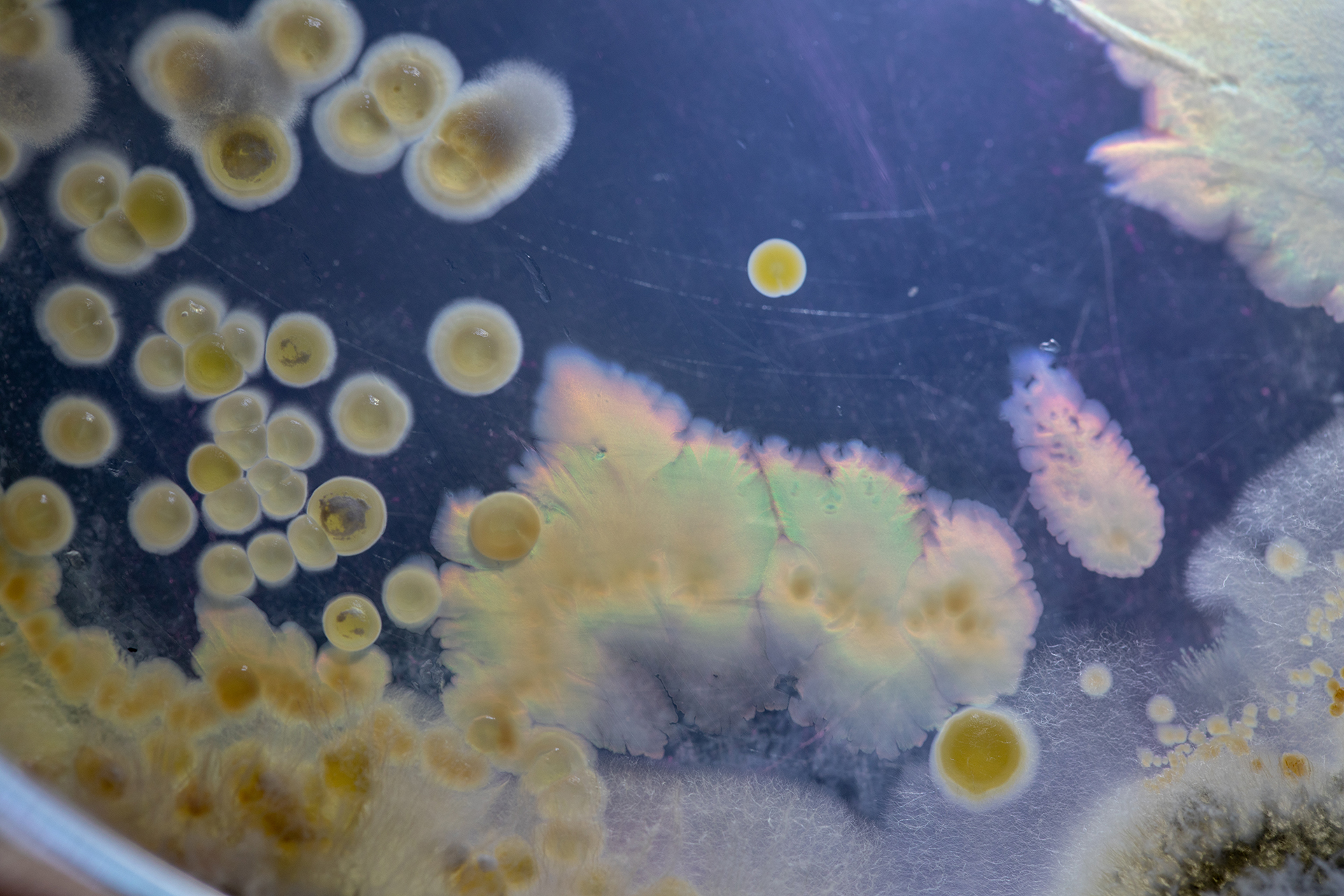 Bacterial growth on agar plate