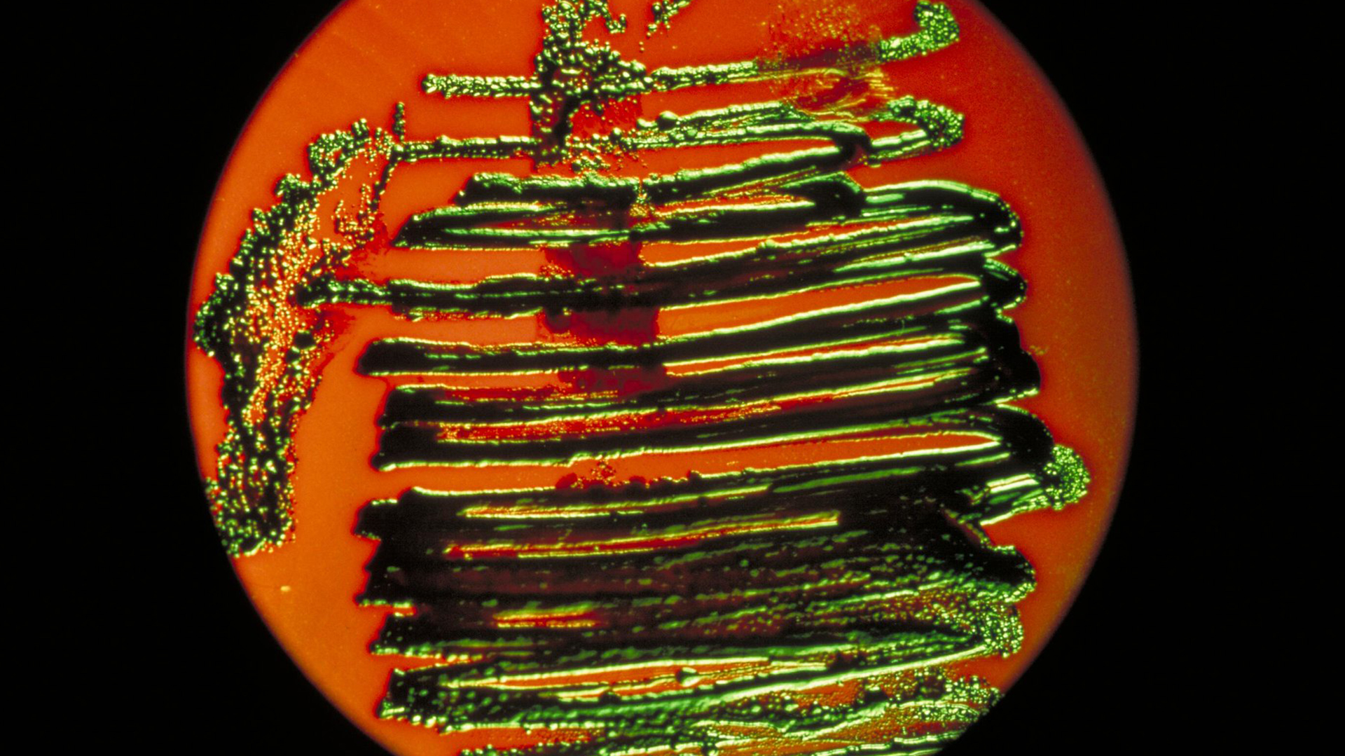 Escherichia coli