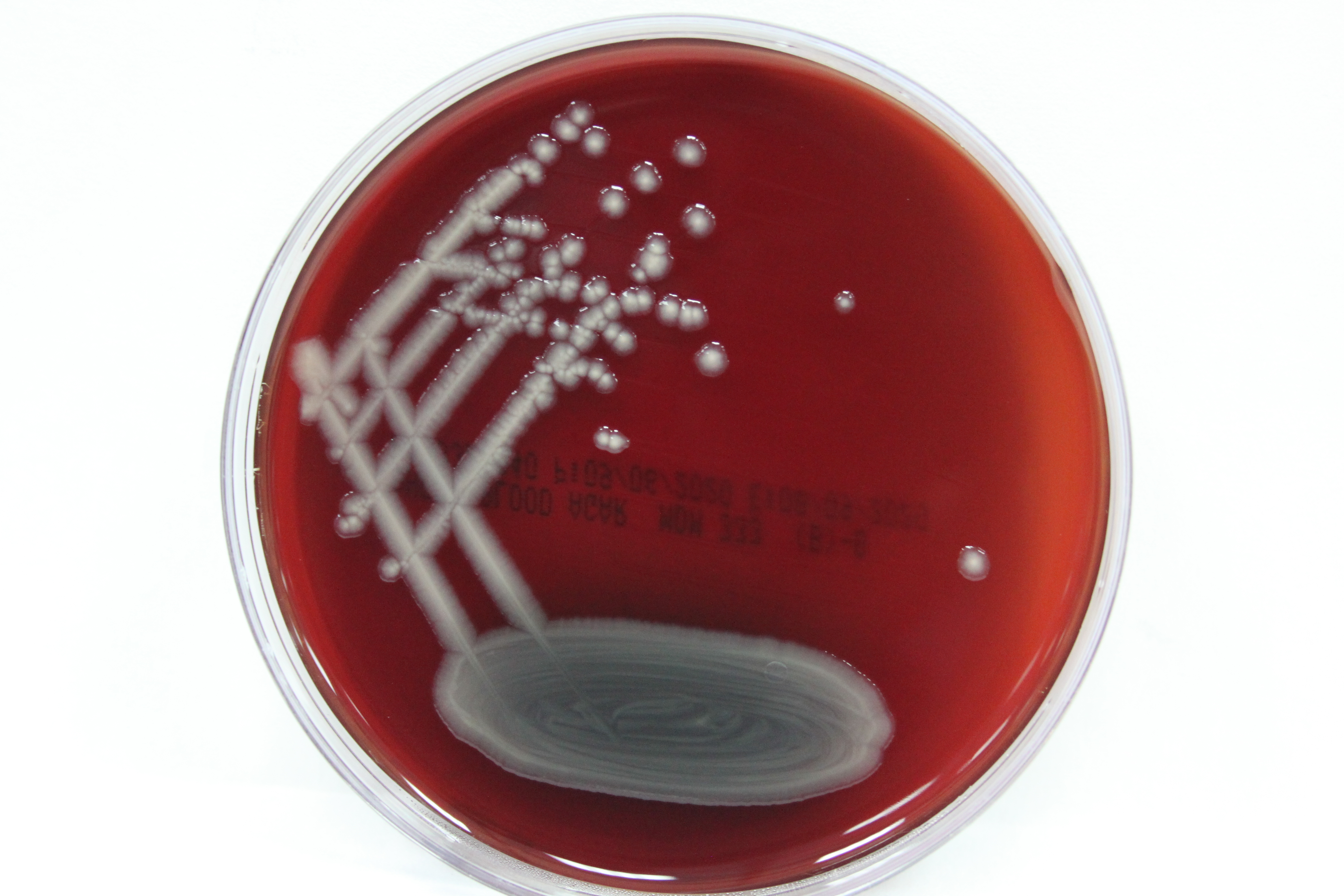 Pseudomonas aeruginosa colonies on blood agar
