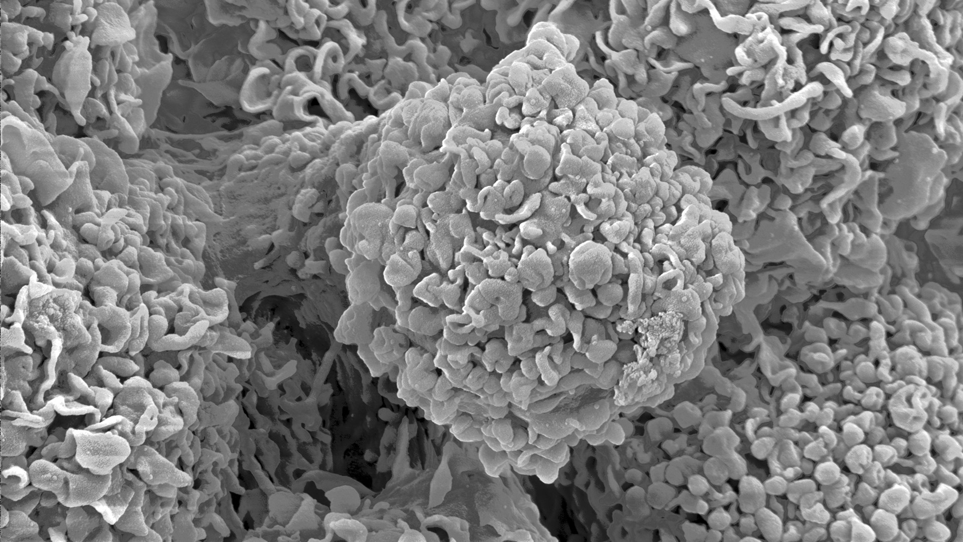 Scanning electron microscopy of single human cells. Extreme close-up of mammalian cell surface morphology. Erythrocytes, connective tissue and collagen fibres.