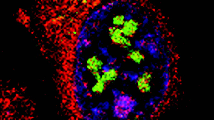   Nuclear protein degradation in PML bodies