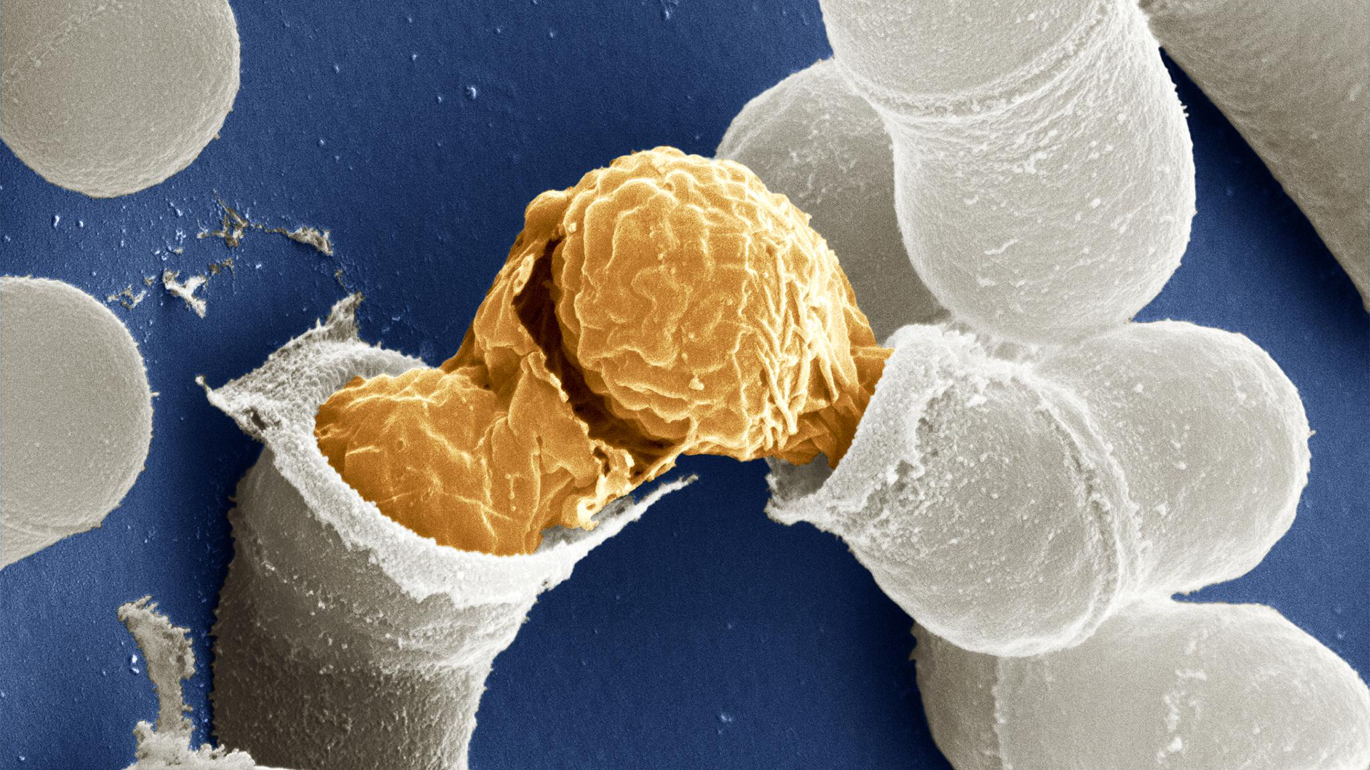 Birth of a yeast cell