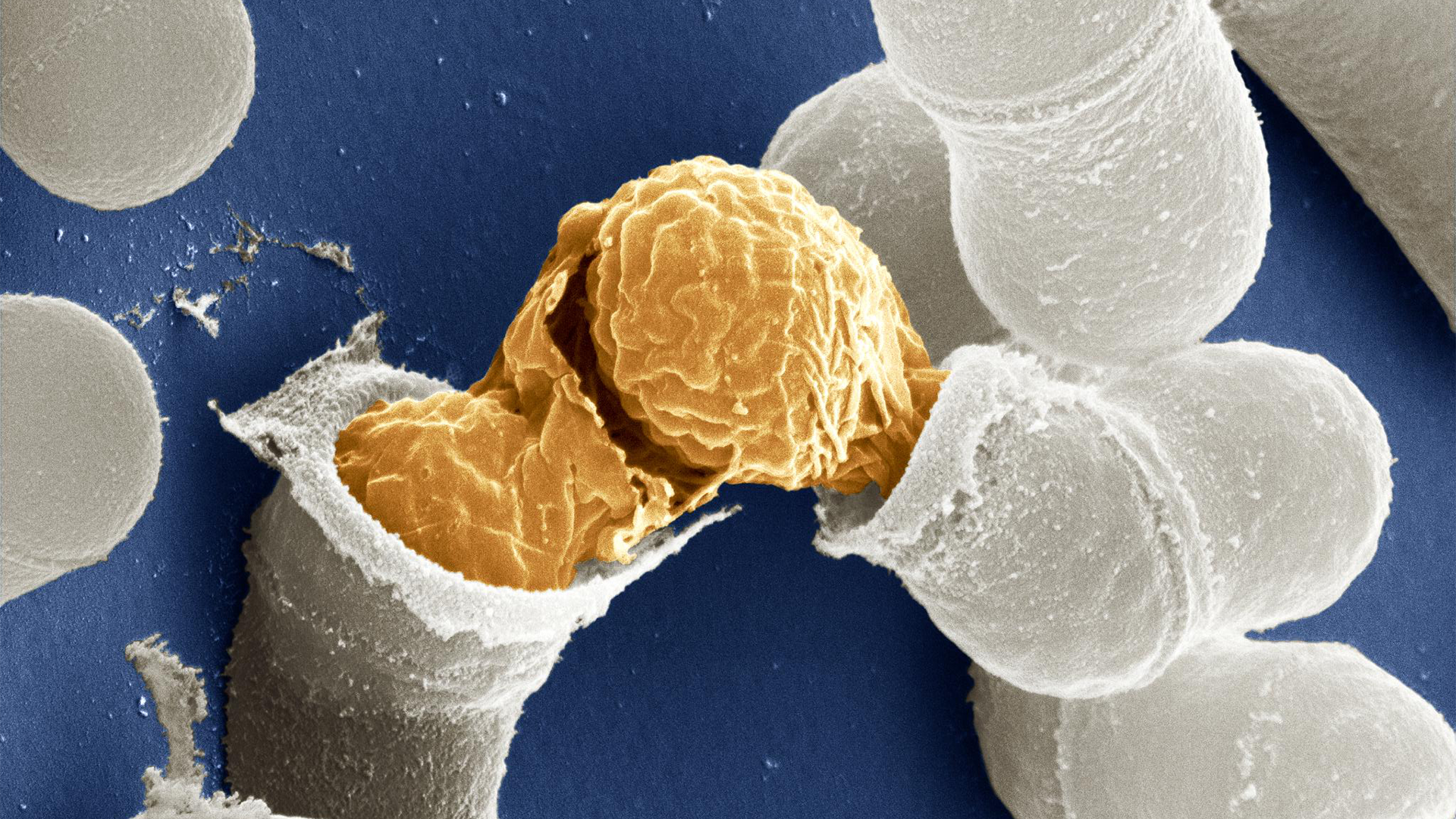 Birth of a yeast cell ©National Institutes of Health (NIH), licensed under CC BY-NC 2.0. Birth of a yeast cell